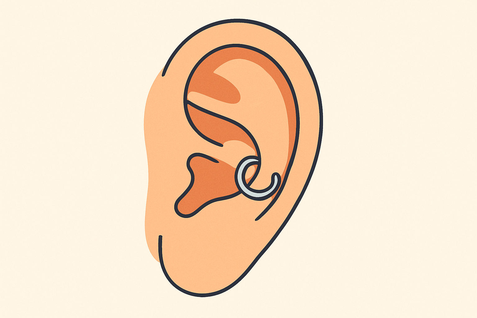 Illustration of a daith piercing: a ring through the innermost cartilage fold above the ear canal